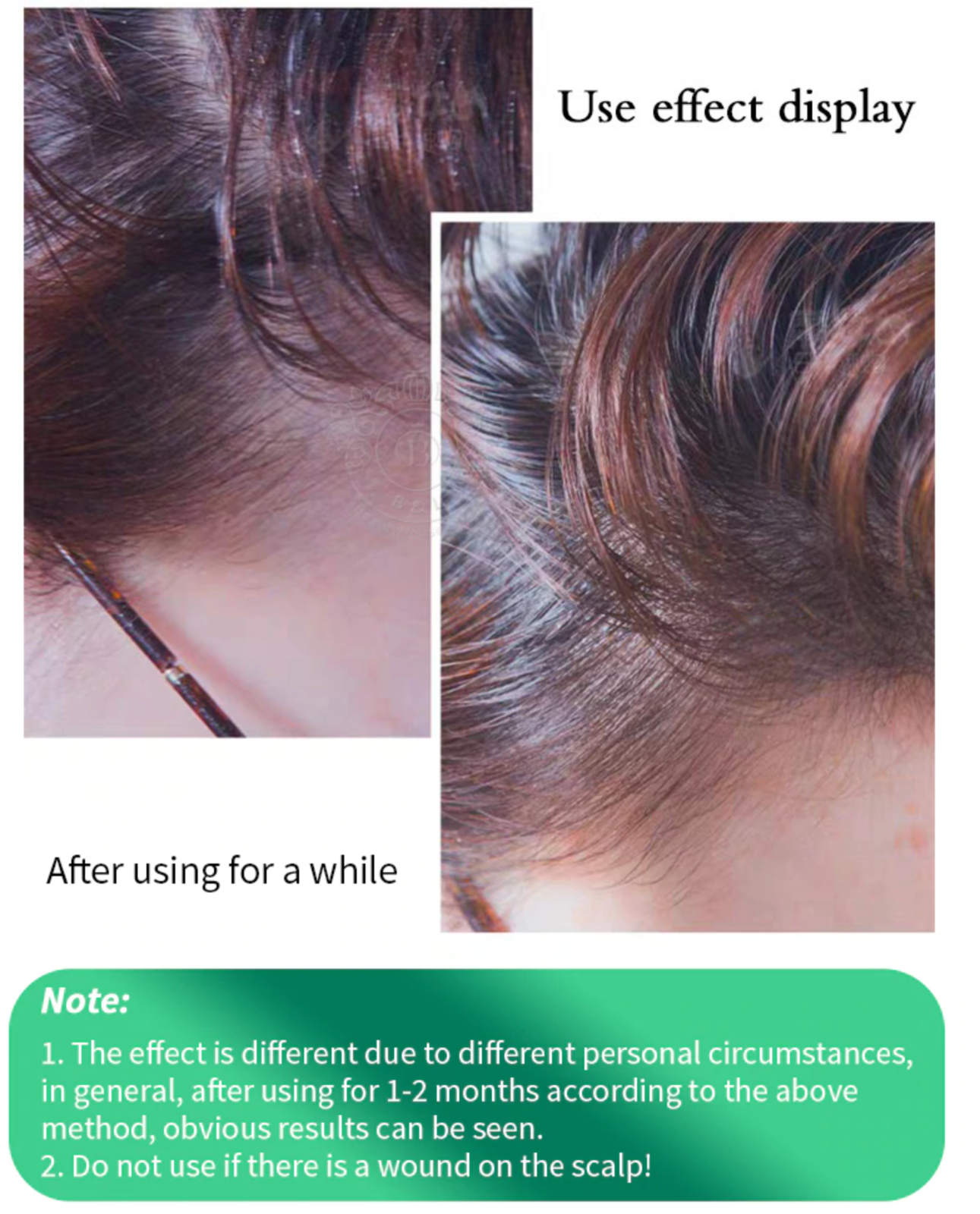 
                  
                    【Bulk Buy】 YANAGIYA Hair Tonic Anti-aging Scalp Tonic for hair loss Menthol Rich 240ml (3 Bottles)
                  
                