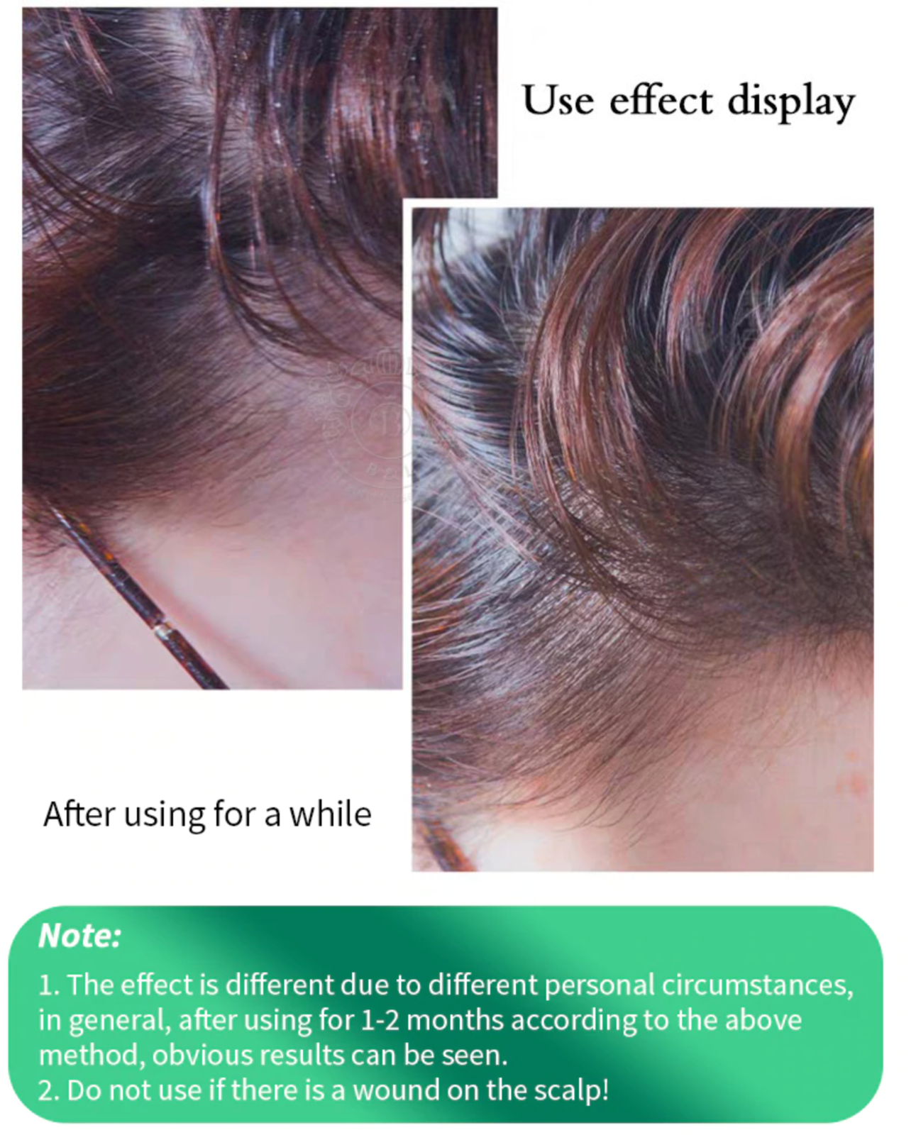
                  
                    Yanagiya Hair Tonic Anti-aging Scalp Tonic for hair loss Menthol Rich 240ml
                  
                