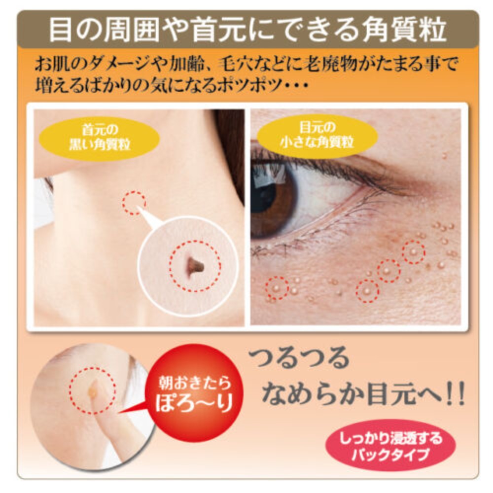 
                  
                    JAPAN TSUBU NIGHT PACK Eye Milia Remover 40g Increased Type
                  
                