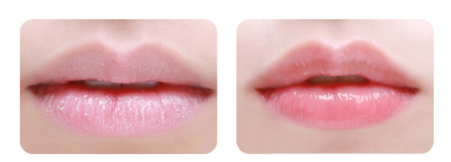 
                  
                    ROHTO MENTHOLATUM XD LipCare Medicated Lip Cream Balm 2pcs
                  
                